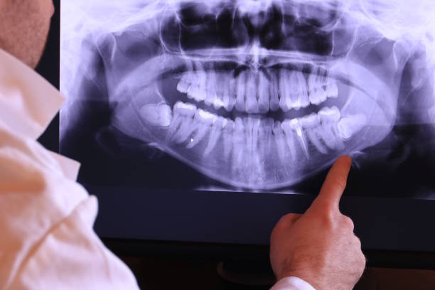 Best Emergency Dental Surgery in Scottsboro, AL
